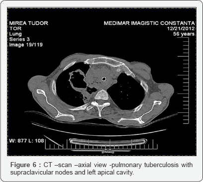 Click here to view Large figure 6