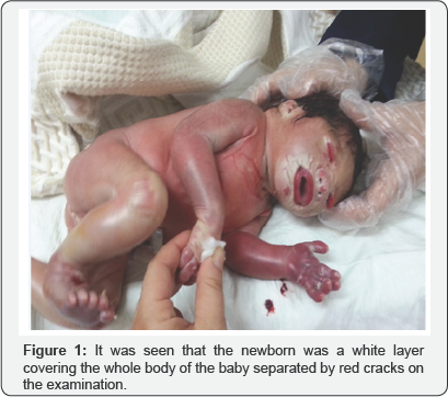 Click here to view Large Figure 1