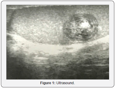 Click here to view Large Figure 1