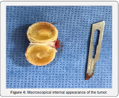 Click here to view Large Figure 4