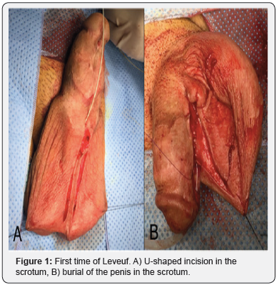 Click here to view Large Figure 1