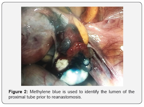 Click here to view Large Figure 2