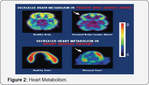 Click here to view Large Figure 2