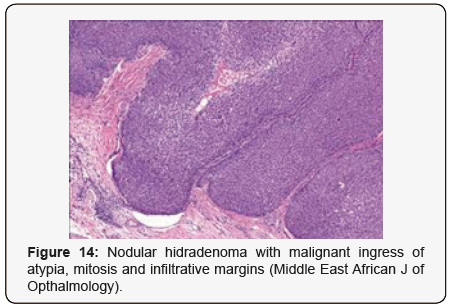 Click here to view Large Figure 14