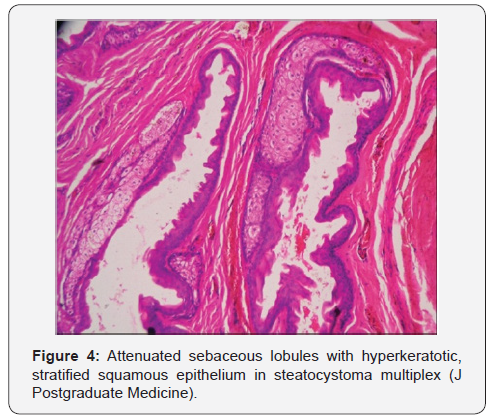 Click here to view Large Figure 4