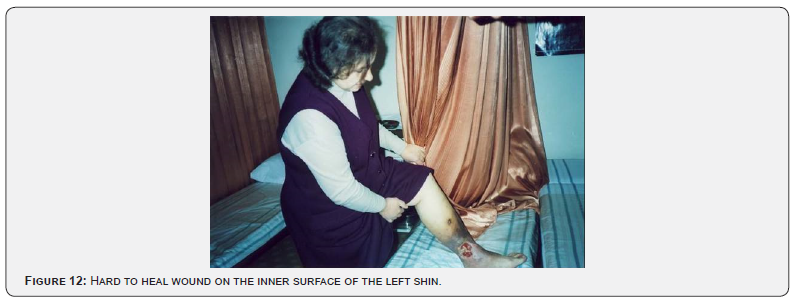 Click here to view Large Figure 12