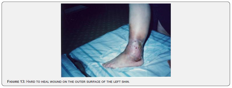 Click here to view Large Figure 13