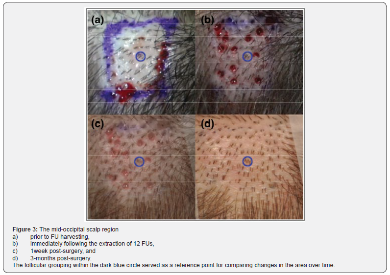 Click here to view Large Figure 3