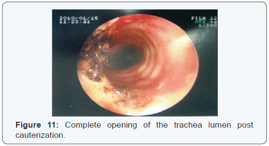 Click here to view Large Figure 11