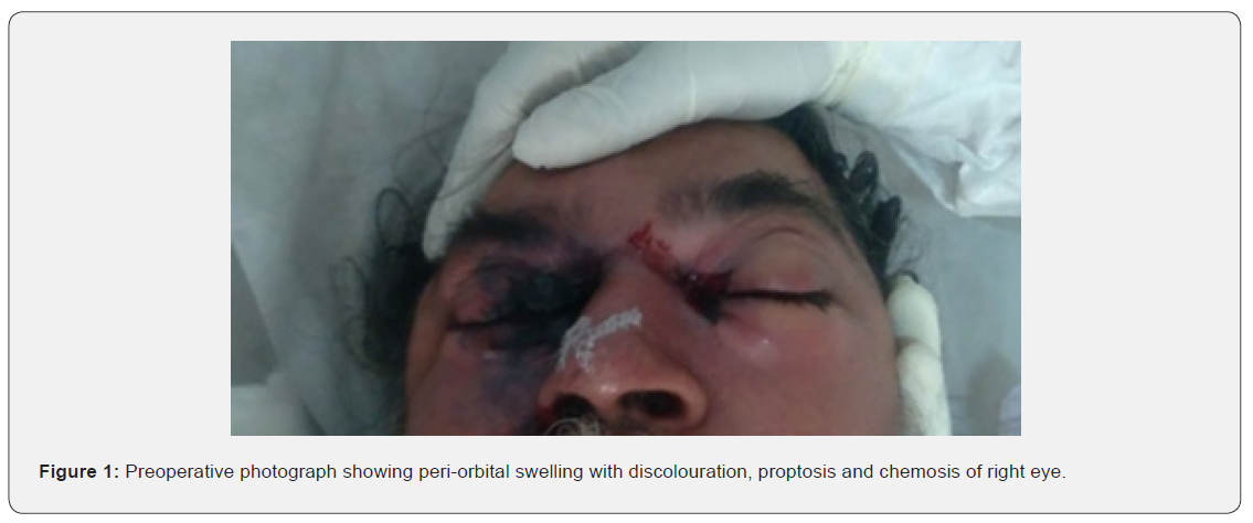 Click here to view Large Figure 1