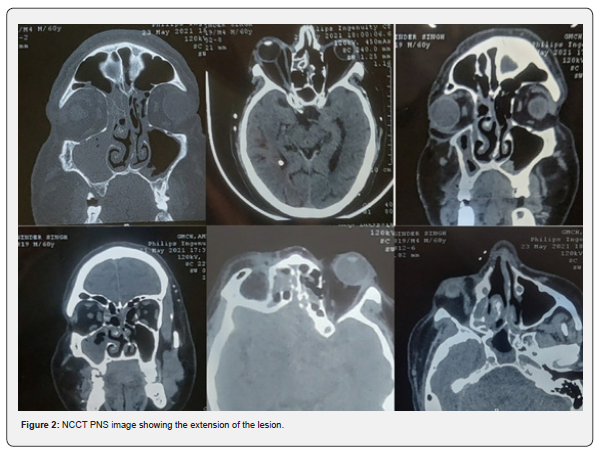 Click here to view Large Figure 2