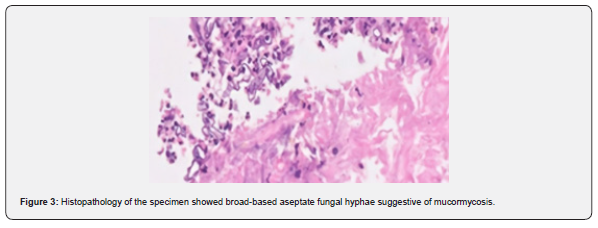 Click here to view Large Figure 3