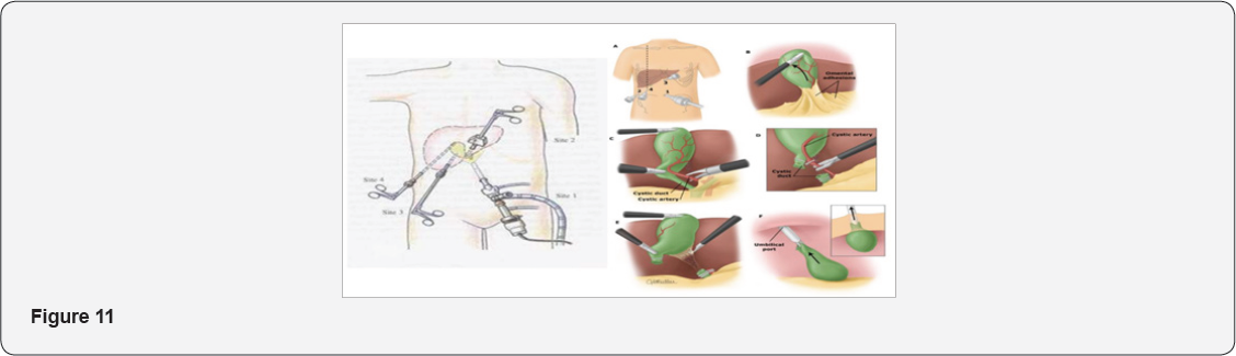 Click here to view Large Figure 11