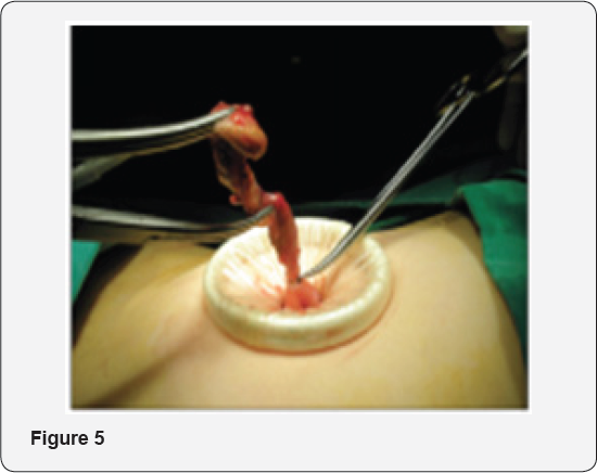 Click here to view Large Figure 5