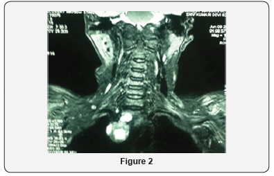 Click here to view Large Figure 2