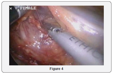 Click here to view Large Figure 4