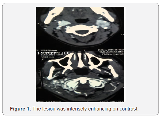 Click here to view Large Figure 1 Journal of Endocrinology and Thyroid Research