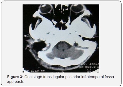 Click here to view Large Figure 3 Journal of Endocrinology and Thyroid Research