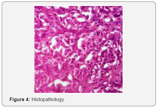 Click here to view Large Figure 4 Journal of Endocrinology and Thyroid Research