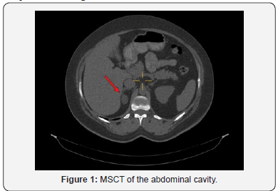 Click here to view Large Figure 1 Journal of Endocrinology and Thyroid Research
