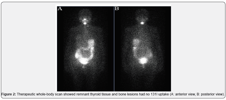 Click here to view Large Figure 2 Journal of Endocrinology and Thyroid Research