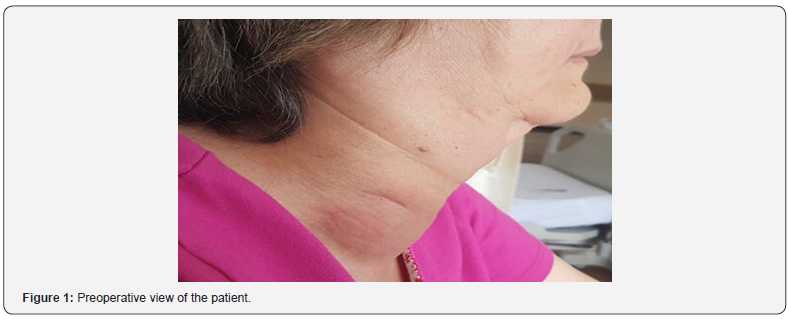 Click here to view Large Figure 1 Journal of Endocrinology and Thyroid Research