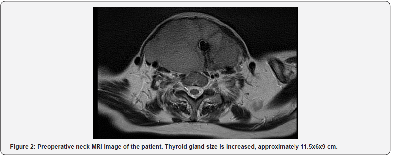 Click here to view Large Figure 2 Journal of Endocrinology and Thyroid Research