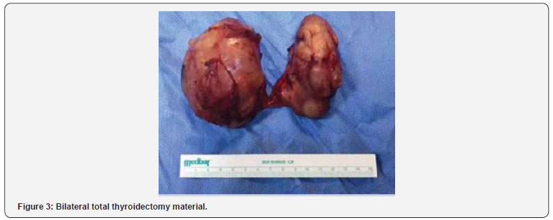 Click here to view Large Figure 3 Journal of Endocrinology and Thyroid Research