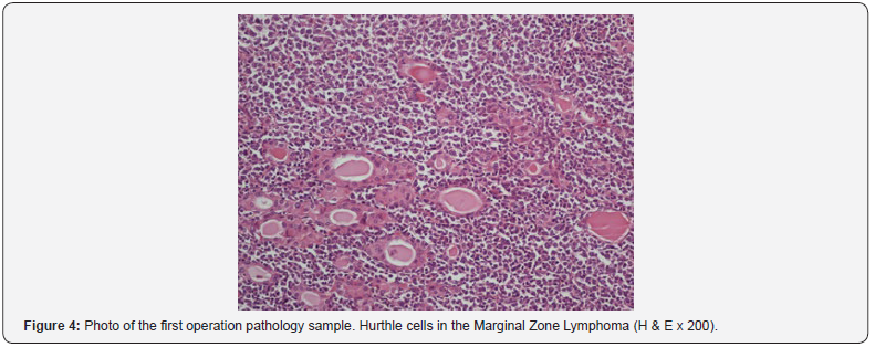 Click here to view Large Figure 4 Journal of Endocrinology and Thyroid Research