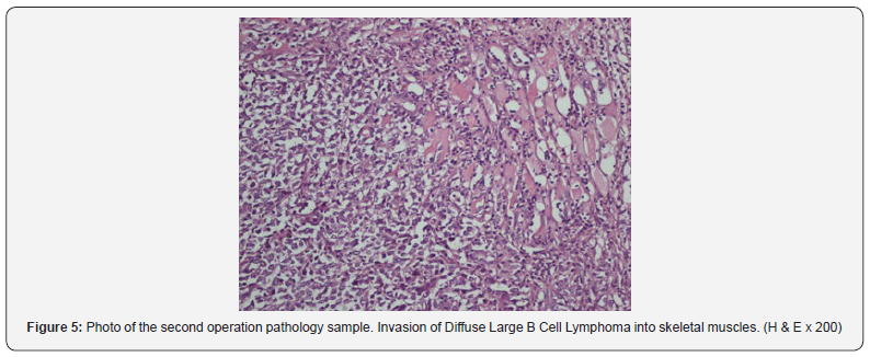 Click here to view Large Figure 5 Journal of Endocrinology and Thyroid Research