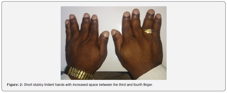 Click here to view Large Figure 2