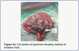 Click here to view Large Figure 4a