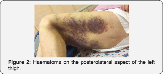 Click here to view Large Figure 2