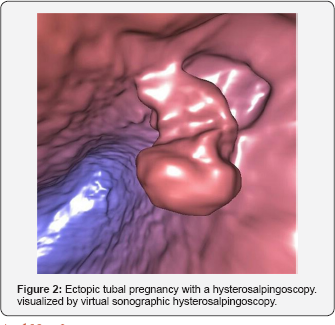 Click here to view Large Figure 2