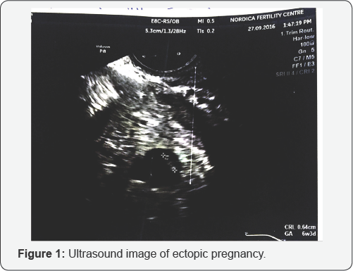 Click here to view Large Table 1