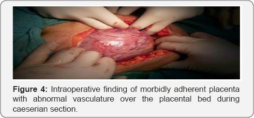 Click here to view Large Table 1