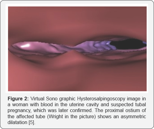 Click here to view Large Figure 2