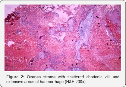 Click here to view Large Figure 2