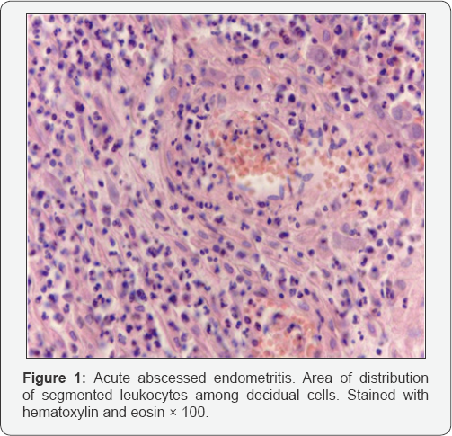 Click here to view Large Figure 1