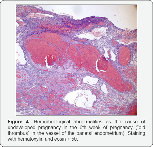 Click here to view Large Figure 4