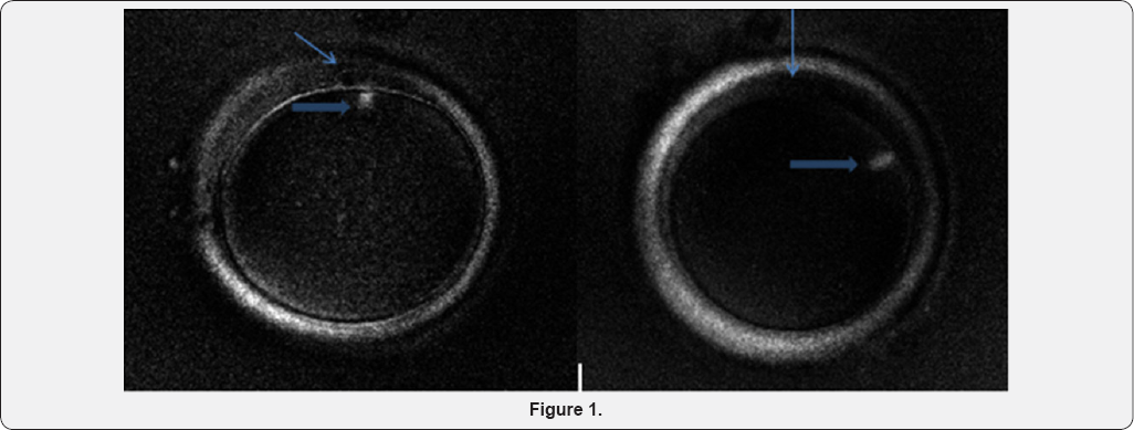 Click here to view Large Figure 1