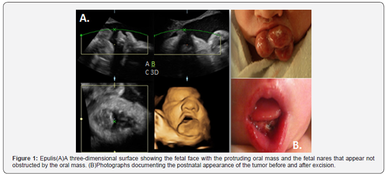 Click here to view Large Figure 1