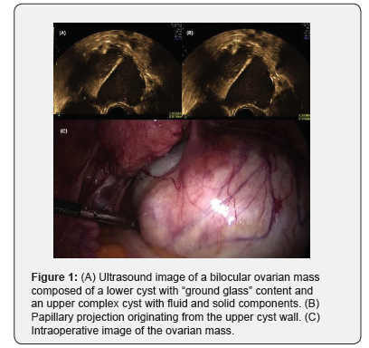 Click here to view Large Figure 1 Journal of Gynecology and Women’s Health
