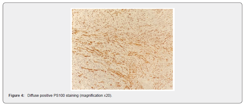 Click here to view Large Figure 4