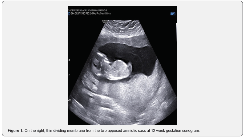 Click here to view Large Figure 1