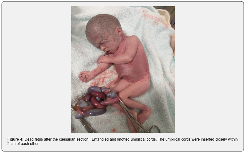 Click here to view Large Figure 4