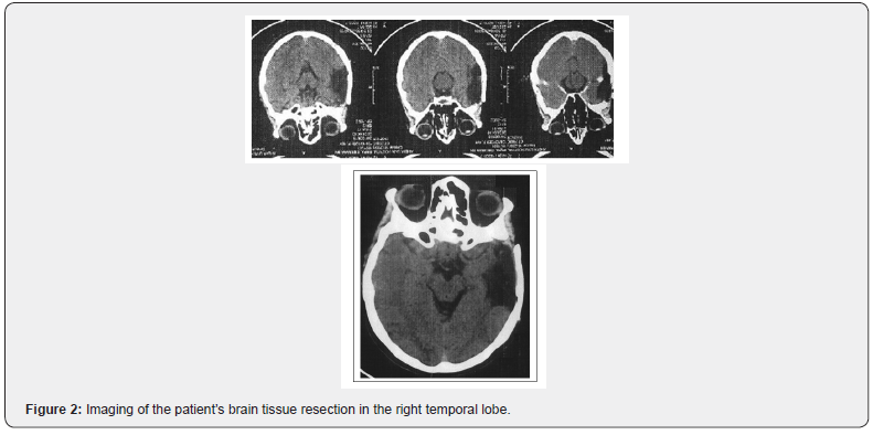 Click here to view Large Figure 2
