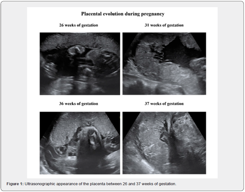 Click here to view Large Figuer 1