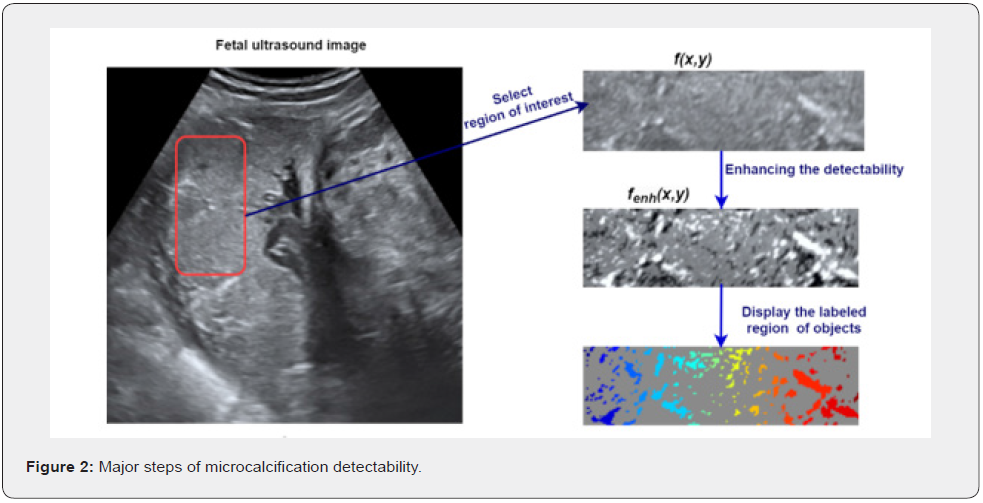 Click here to view Large Figuer 2