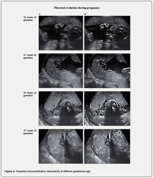 Click here to view Large Figuer 3